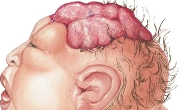If you (or your partner) was pregnent and the child is severly sick and WILL die within a month after birth. Would you abort it?