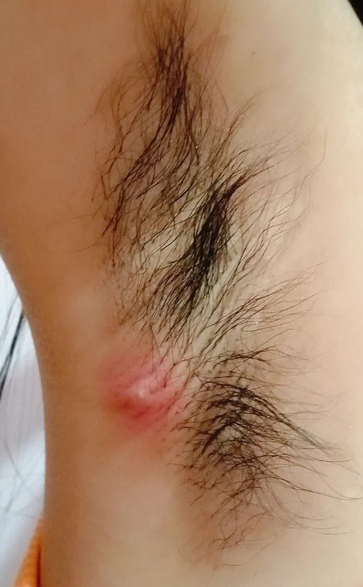 How can she treat this?