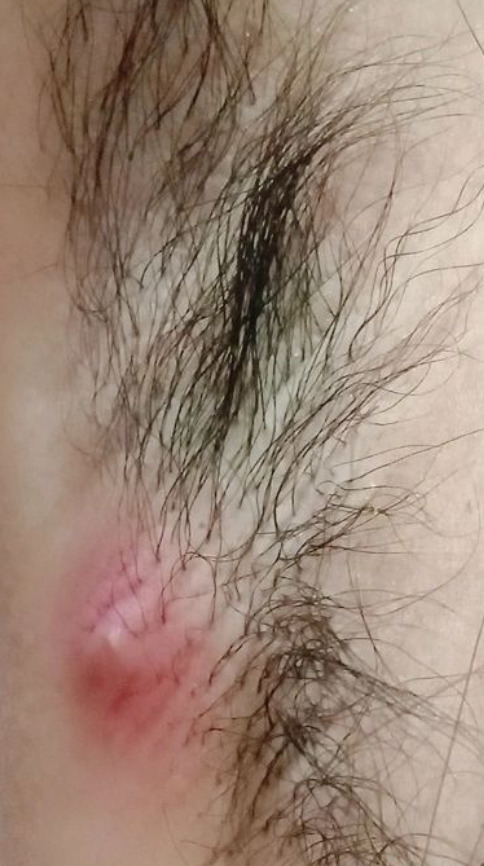 How can she treat this?