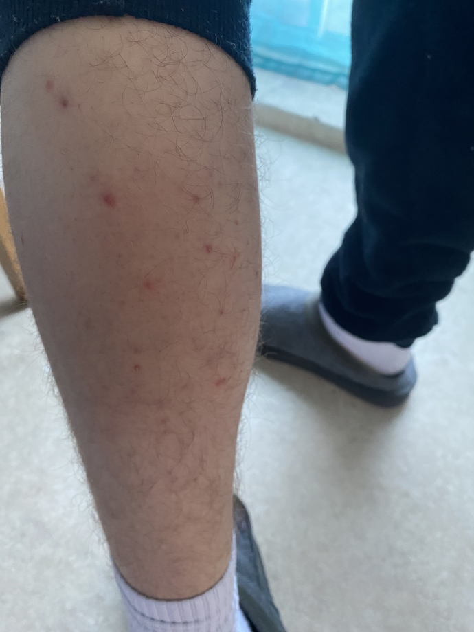 What has caused these spots?