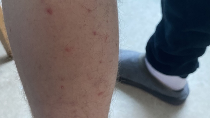 What has caused these spots?