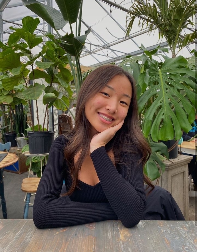 Guys, What do guys think about braces?