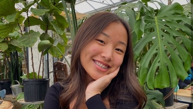 Guys, What do guys think about braces?