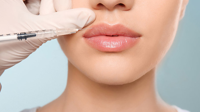 Guys, what’s your opinion on lip fillers?