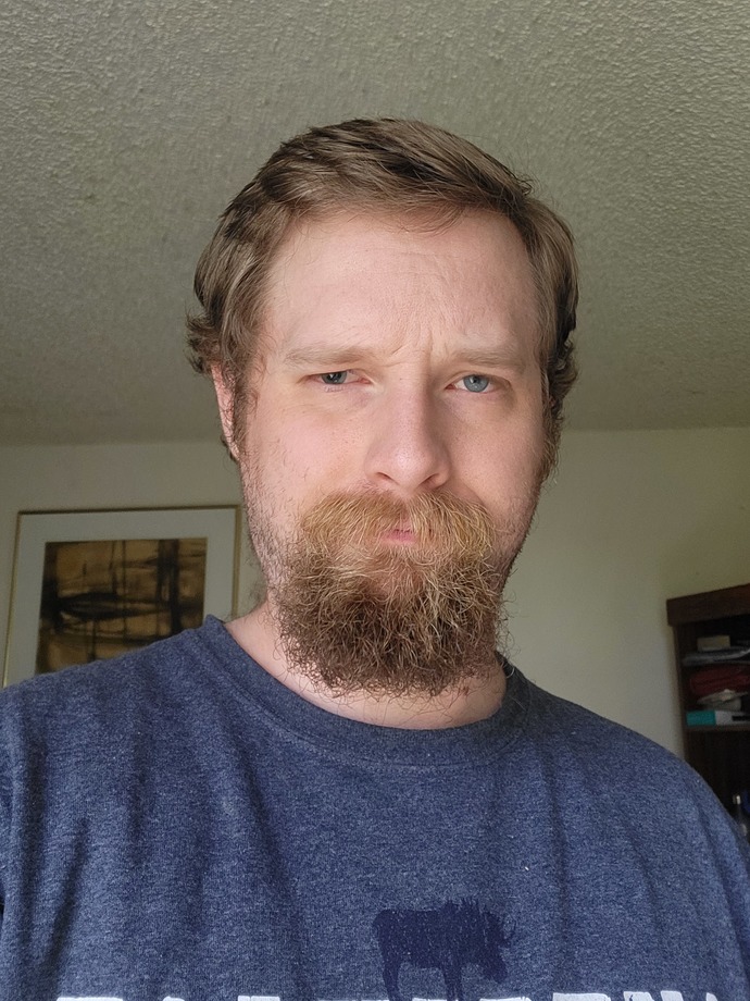 Does this hair style with this goatee look bad?