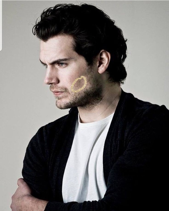 Where is the freckle on Henry Cavills face?