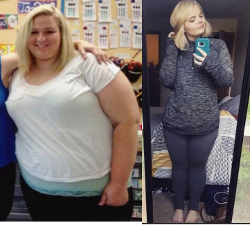 What are your thoughts on dating a girl who has had massive weight loss?