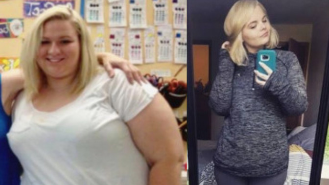 What are your thoughts on dating a girl who has had massive weight loss?