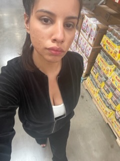 Why can’t I just accept myself? How to not feel the pressure of getting plastic surgery done?