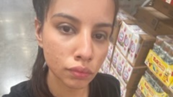 Why can’t I just accept myself? How to not feel the pressure of getting plastic surgery done?