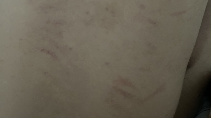 Is my boyfriend cheating? Lots of scratch marks?