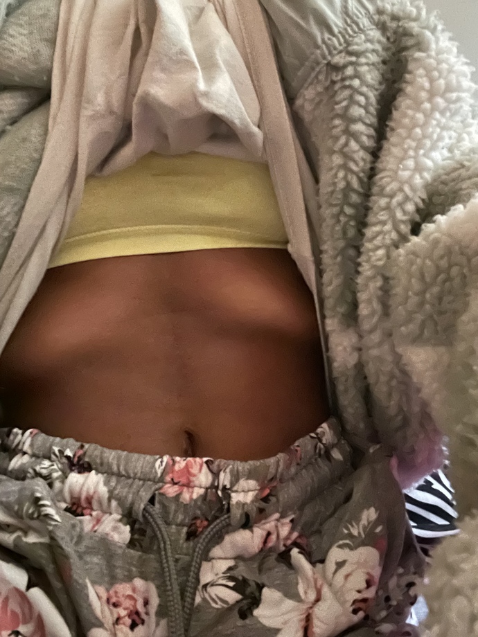Is it bad that I’m trying to not eat even though naturally if I breath in lots you can see my rib cage?