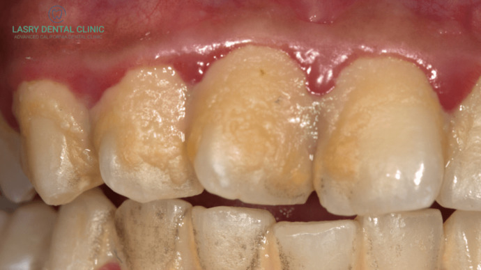 Would you date someone who never goes to the dentist?