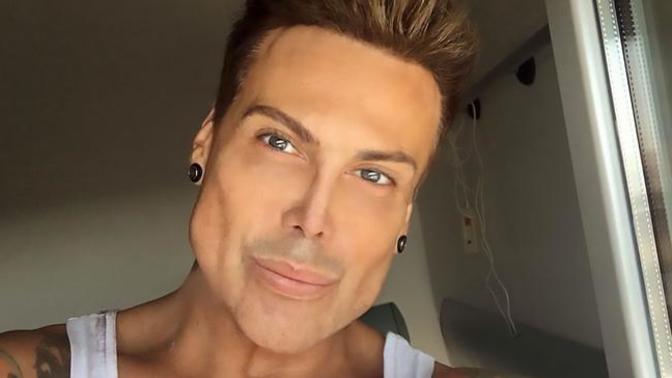 Would you date someone who got cosmetic surgery?