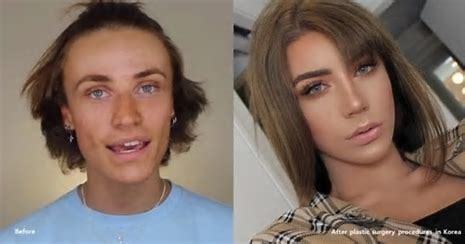 Does plastic surgery work?