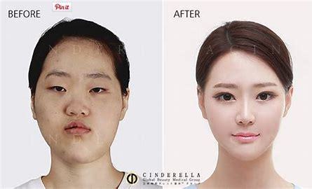 Does plastic surgery work?