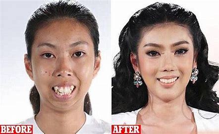 Does plastic surgery work?