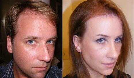 Does plastic surgery work?