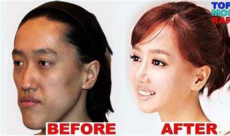 Does plastic surgery work?