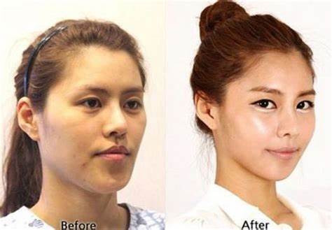 Does plastic surgery work?