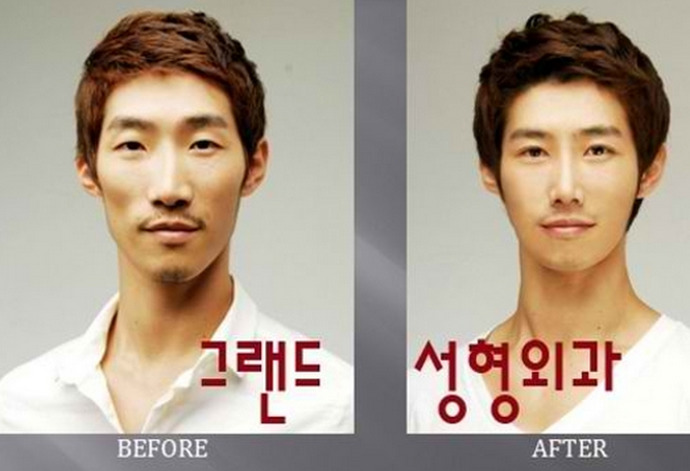 Does plastic surgery work?