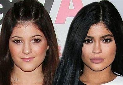 Does plastic surgery work?