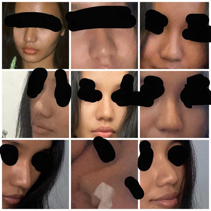 Help me find my nose shape?