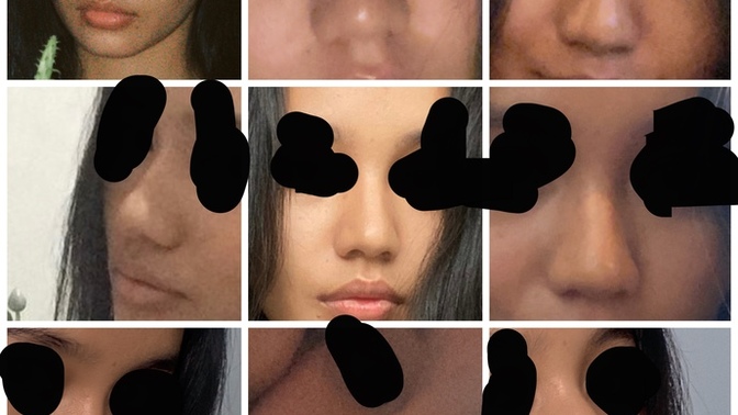Help me find my nose shape?