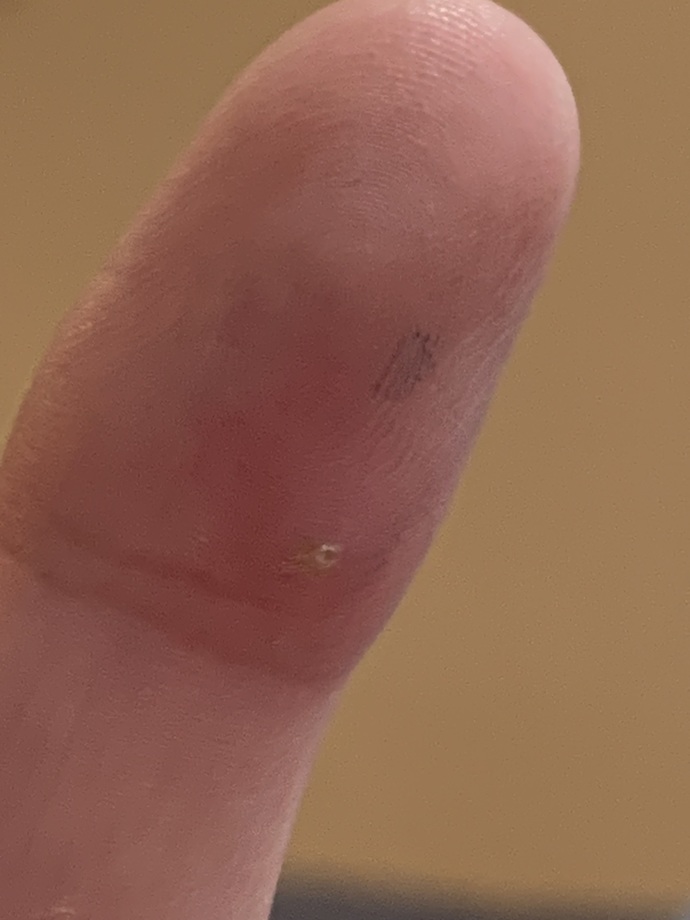 What’s On My Finger?
