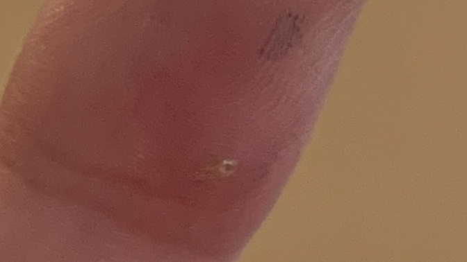 What’s On My Finger?