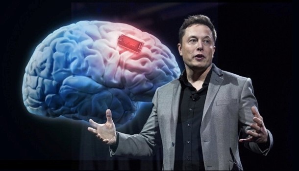 FDA approves Elon Musk brain chip trial on humans. Your thoughts on that?