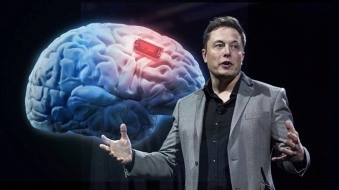 FDA approves Elon Musk brain chip trial on humans. Your thoughts on that?
