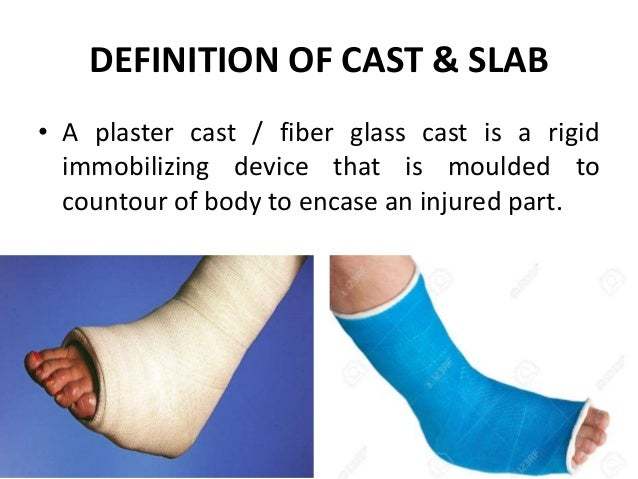 Do. you get to choosethr color of your cast wrapping?