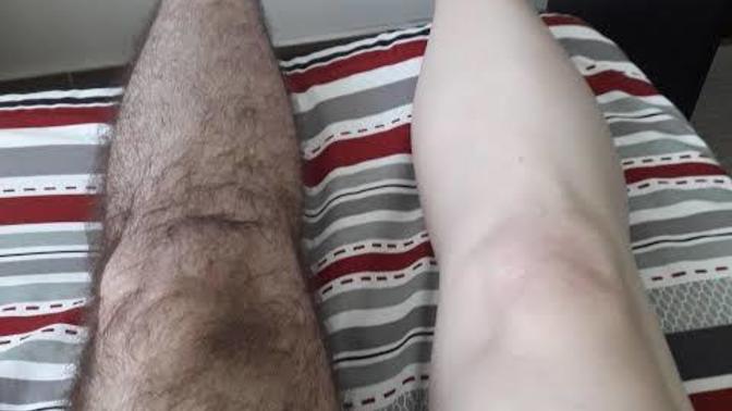 Shaved legs on a man who otherwise has very hairy?