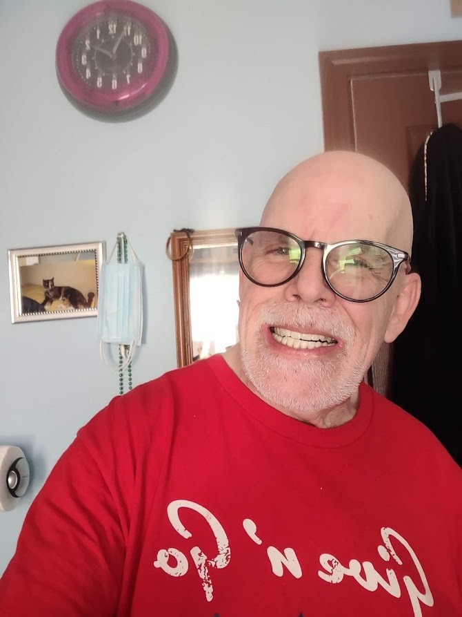 Should I get a hair transplant or just stay bald?