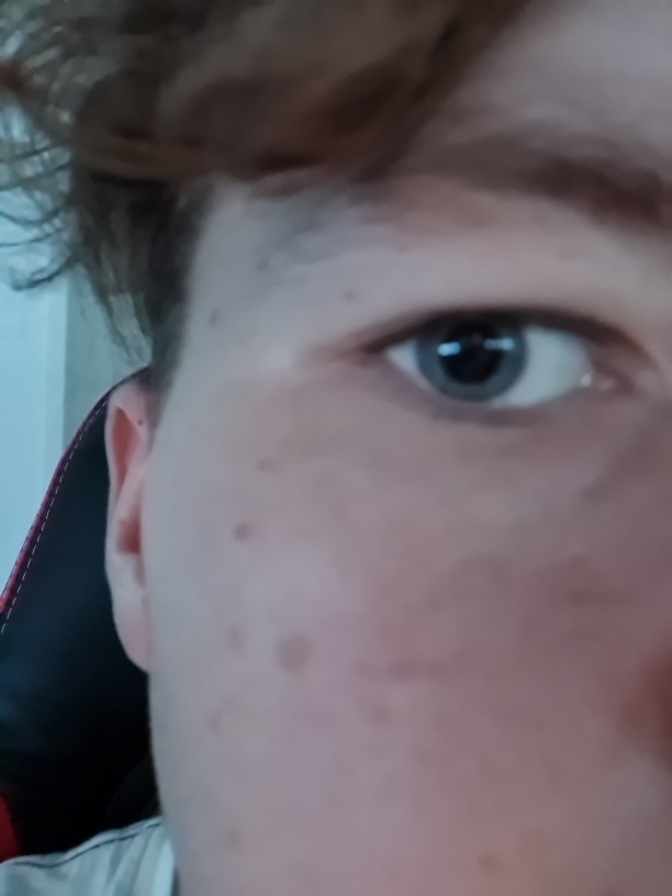 I want to do plastic surgery to make my eyes more Asian?