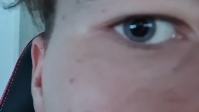 I want to do plastic surgery to make my eyes more Asian?