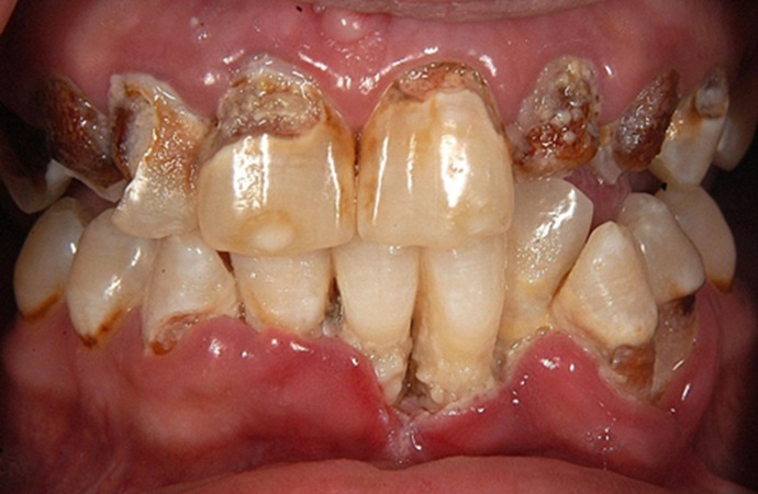 Do you brush your teeth, floss, AND use mouthwash?