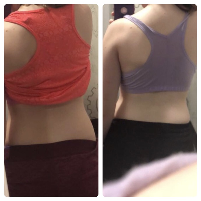 Is it normal to bloat this much?
