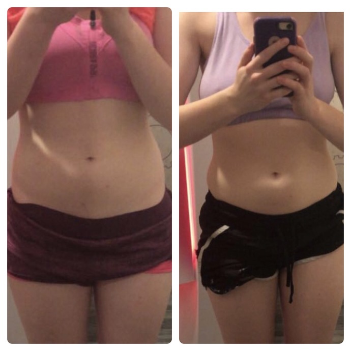 Is it normal to bloat this much?
