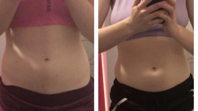 Is it normal to bloat this much?