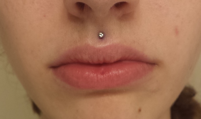 What are your thoughts on Medusa piercings?
