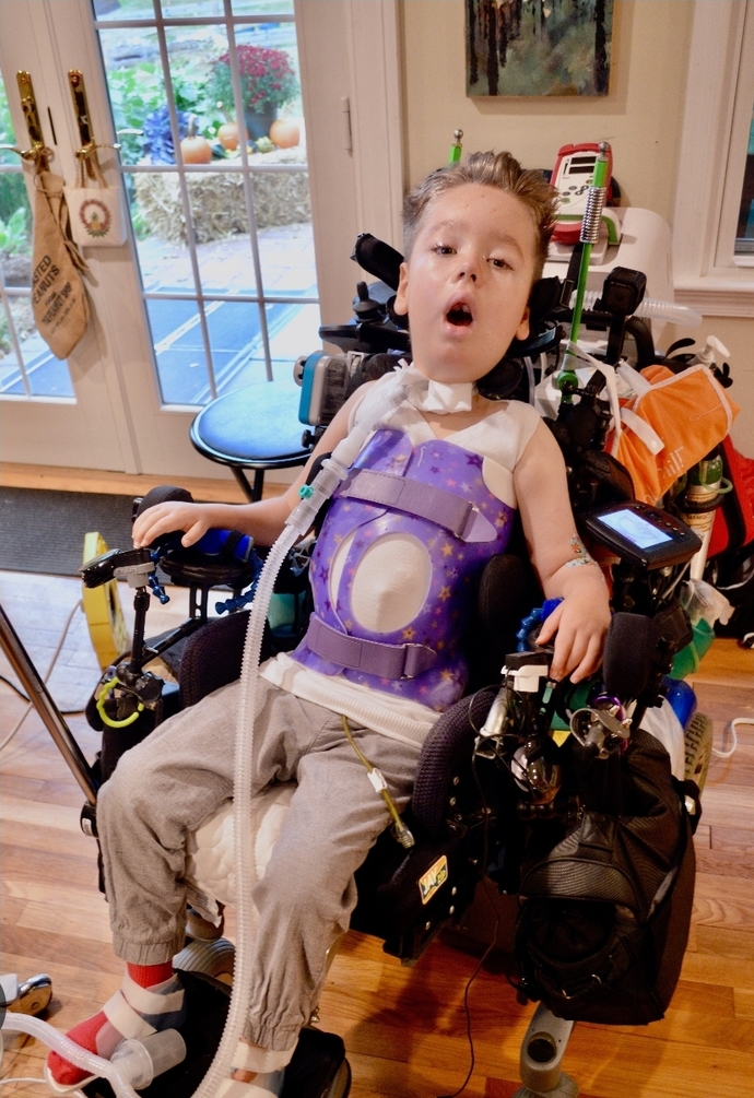 If you knew you would become paralyzed from feet to neck in 10 years from now. Would you want to be put to sleep?