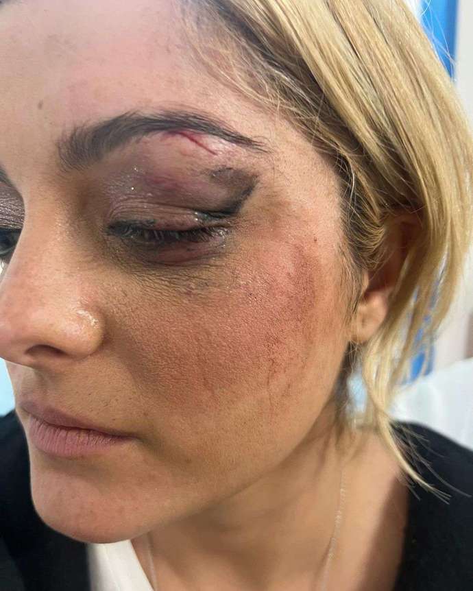 Thoughts about Bebe Rexha’s situation?