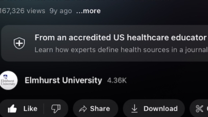 What’s your opinion on Experts?
