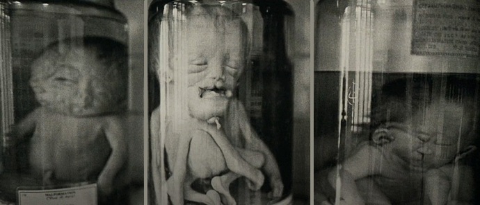 [+18 - Graphic] Do you know what inbreeding does to the fetus?