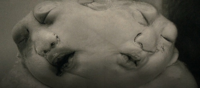 [+18 - Graphic] Do you know what inbreeding does to the fetus?
