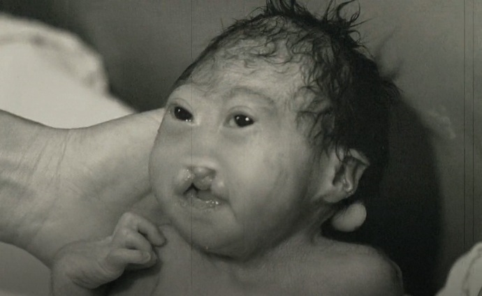 [+18 - Graphic] Do you know what inbreeding does to the fetus?