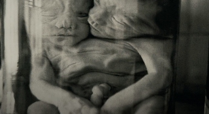 [+18 - Graphic] Do you know what inbreeding does to the fetus?