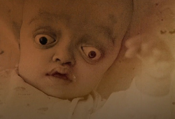 [+18 - Graphic] Do you know what inbreeding does to the fetus?
